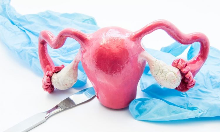 Do You REALLY Need A Hysterectomy?